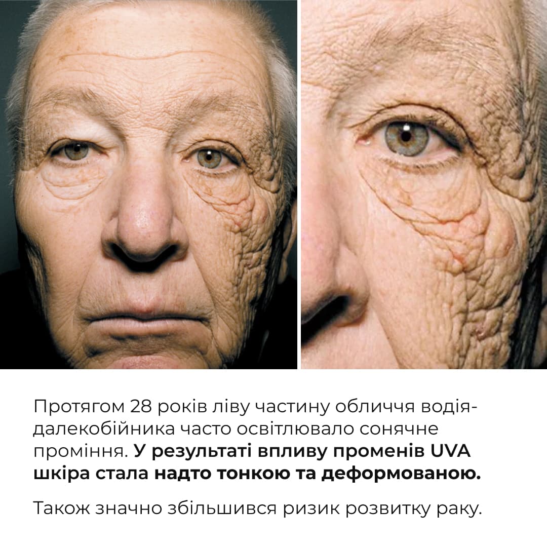 Комплекс для відновлення тону та захист від пігментації SPF 30 Hillary Tone Repair & Pigment Defense Set thumbnail