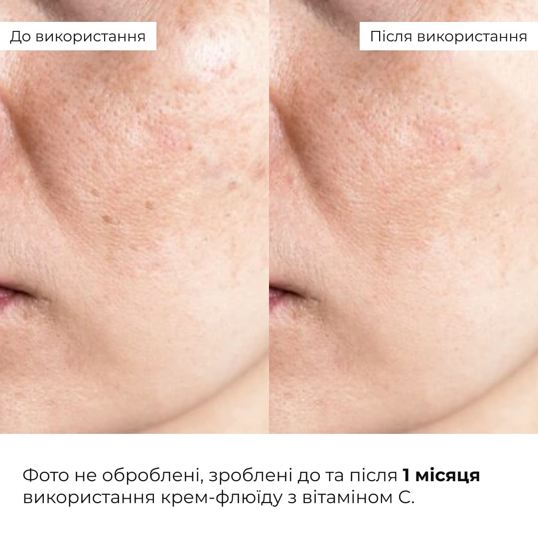 Комплекс для відновлення тону та захист від пігментації SPF 30 Hillary Tone Repair & Pigment Defense Set thumbnail