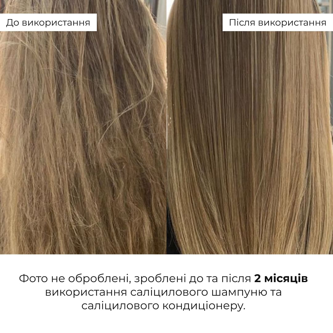 Набір для відновлення та зволоження шкіри, волосся і губ Hillary Total Skin, Hair & Lip Care Set thumbnail