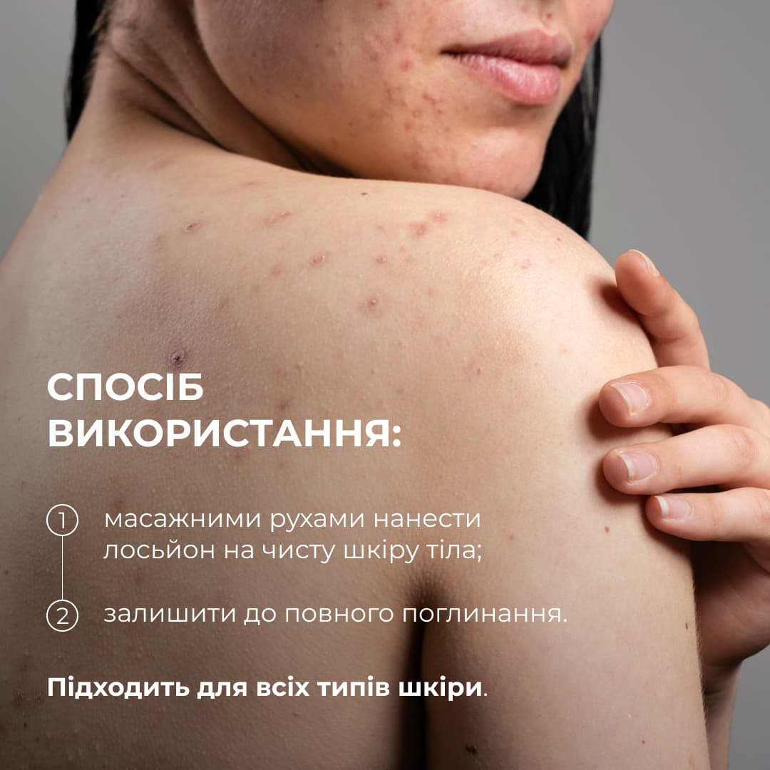 Комплекс проти висипань на тілі та глибокого живлення Hillary Body Acne & Deep Nourishment Complex thumbnail