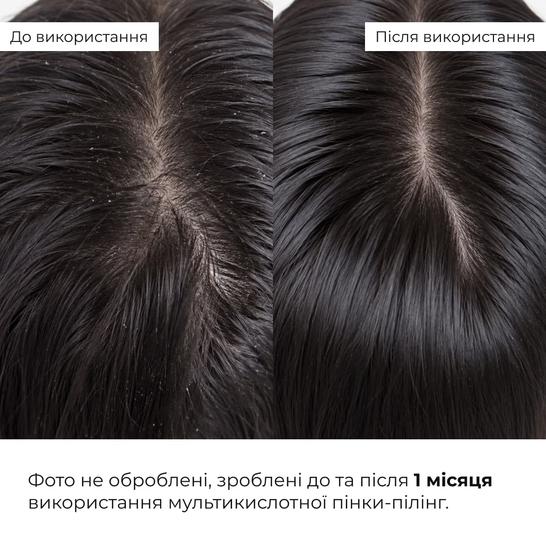 Комплекс для глибокого очищення та відновлення волосся Hillary Deep Cleansing & Hair Recovery Complex, 500 мл thumbnail