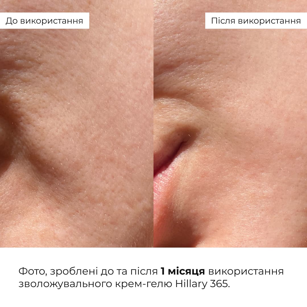 Набір для зволоження, очищення та освітлення шкіри Hillary Daily Hydration, Cleanse & Glow Set thumbnail