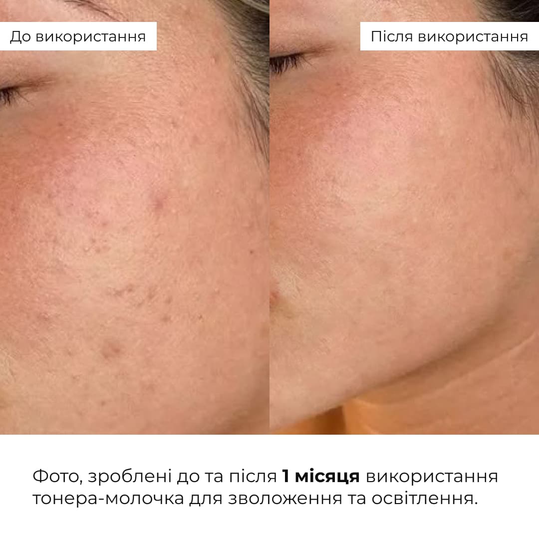 Набір для зволоження, очищення та освітлення шкіри Hillary Daily Hydration, Cleanse & Glow Set thumbnail