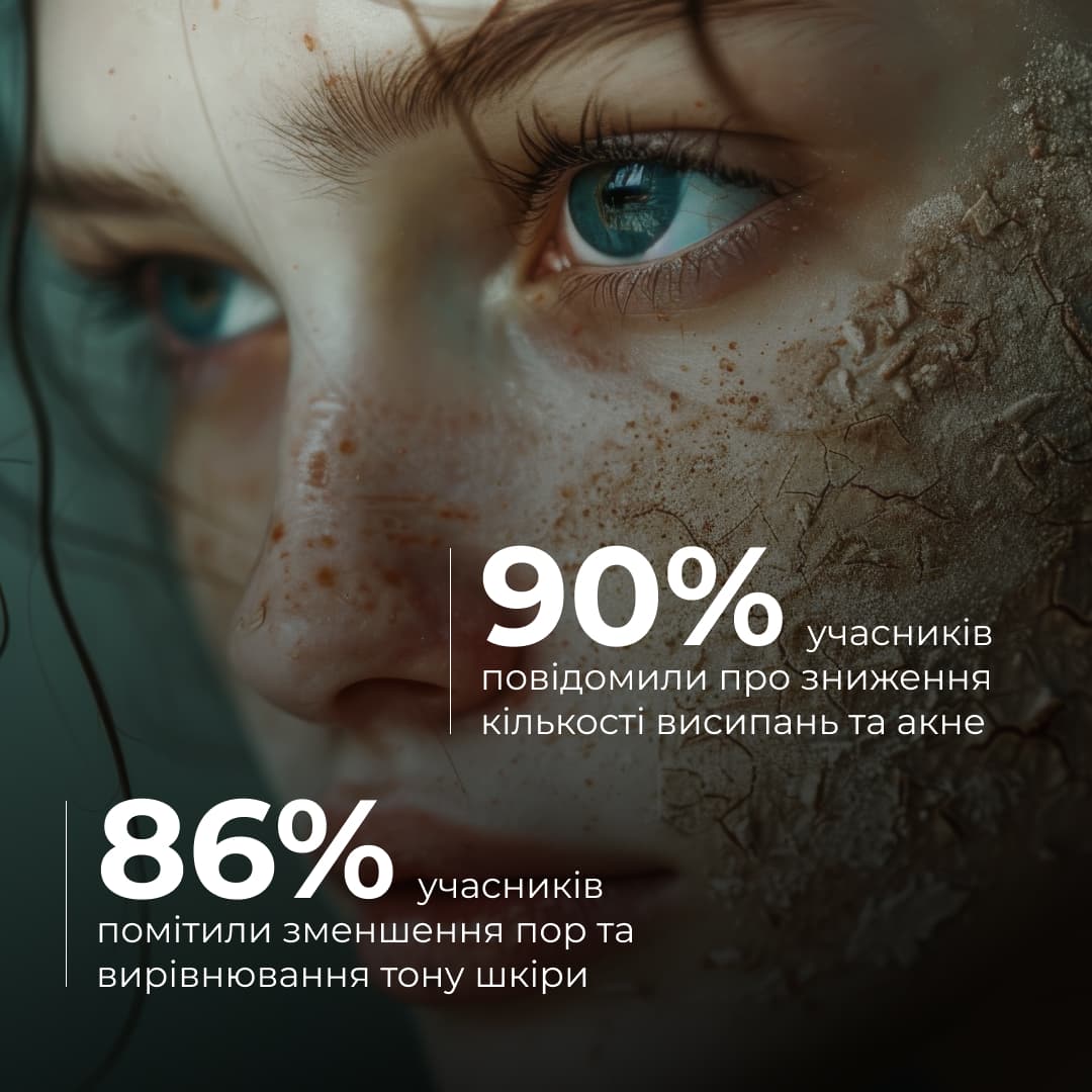 Набір детоксикації та боротьби з акне Hillary Acne Control & Detox Skin Kit thumbnail