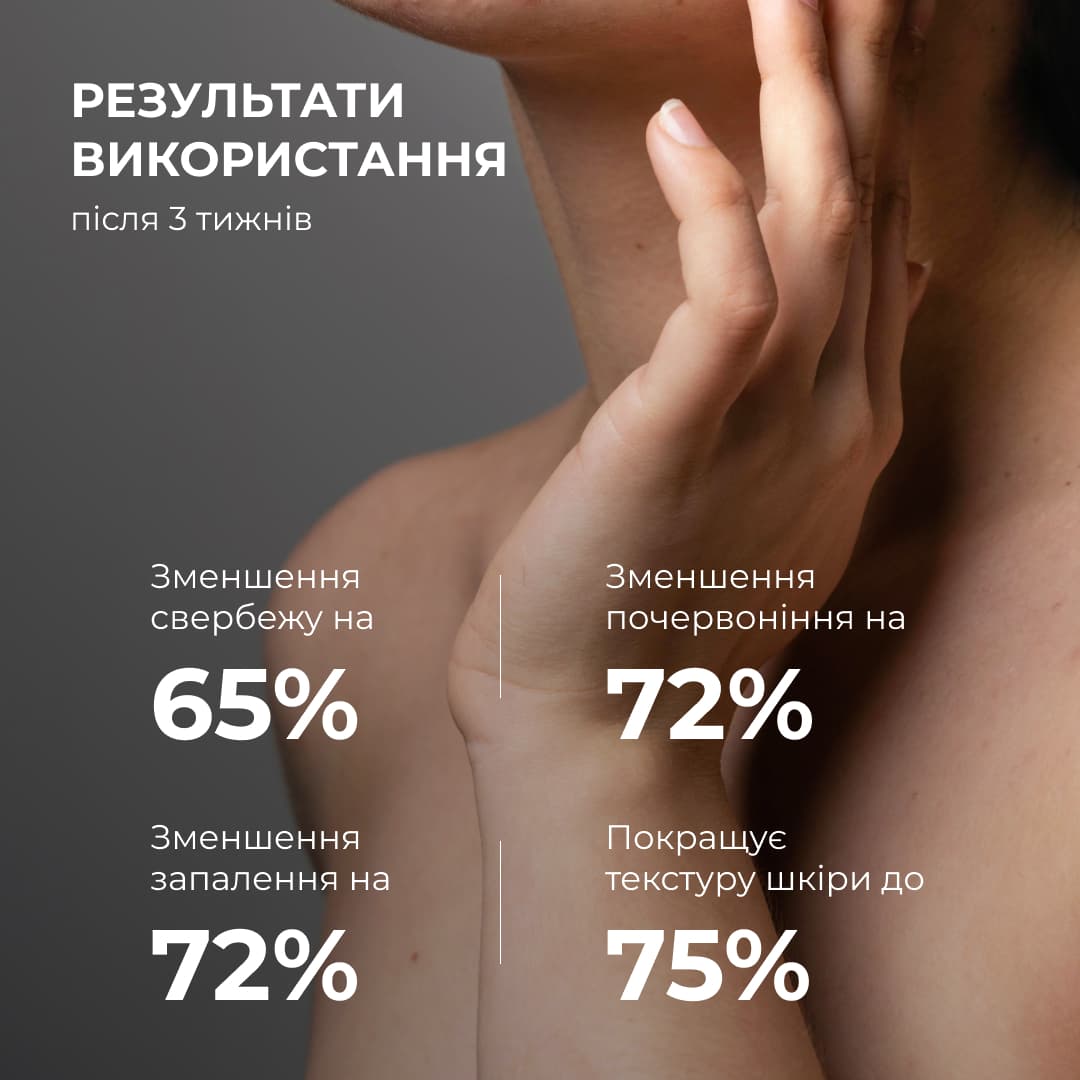 Лосьйон-детокс для проблемної шкіри з саліциловою кислотою Hillary Anti-Acne Salicylic Body Lotion, 150 мл thumbnail