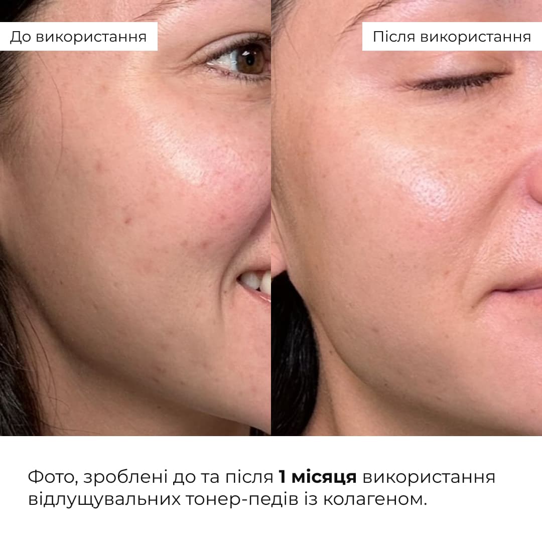Комплекс для освітлення пігментних плям та захисту шкіри Hillary Dark Spot Brightening & Skin Protection Complex thumbnail