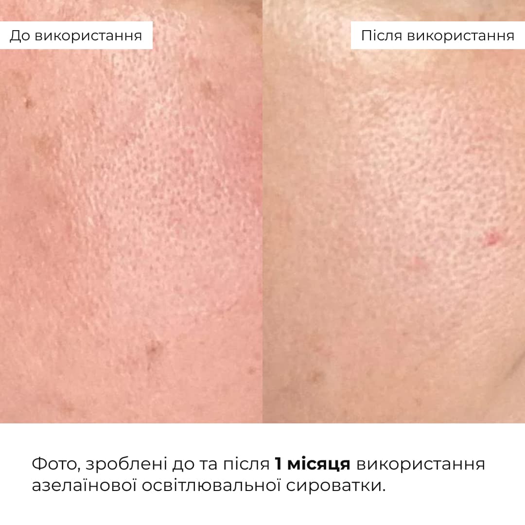 Комплекс для сяйва й захисту шкіри SPF30 Hillary Brightening and Skin Protection Complex thumbnail