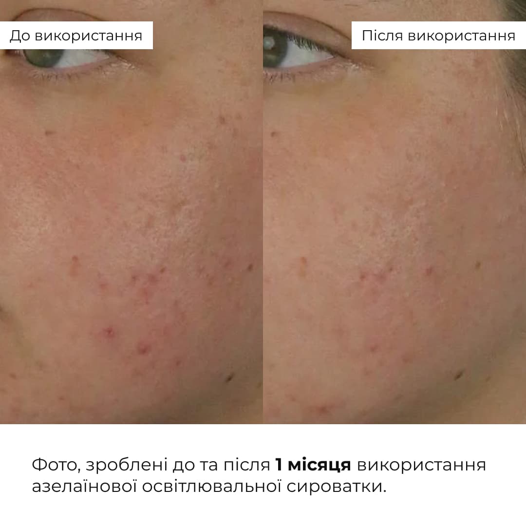 Комплекс для сяйва й захисту шкіри SPF30 Hillary Brightening and Skin Protection Complex thumbnail
