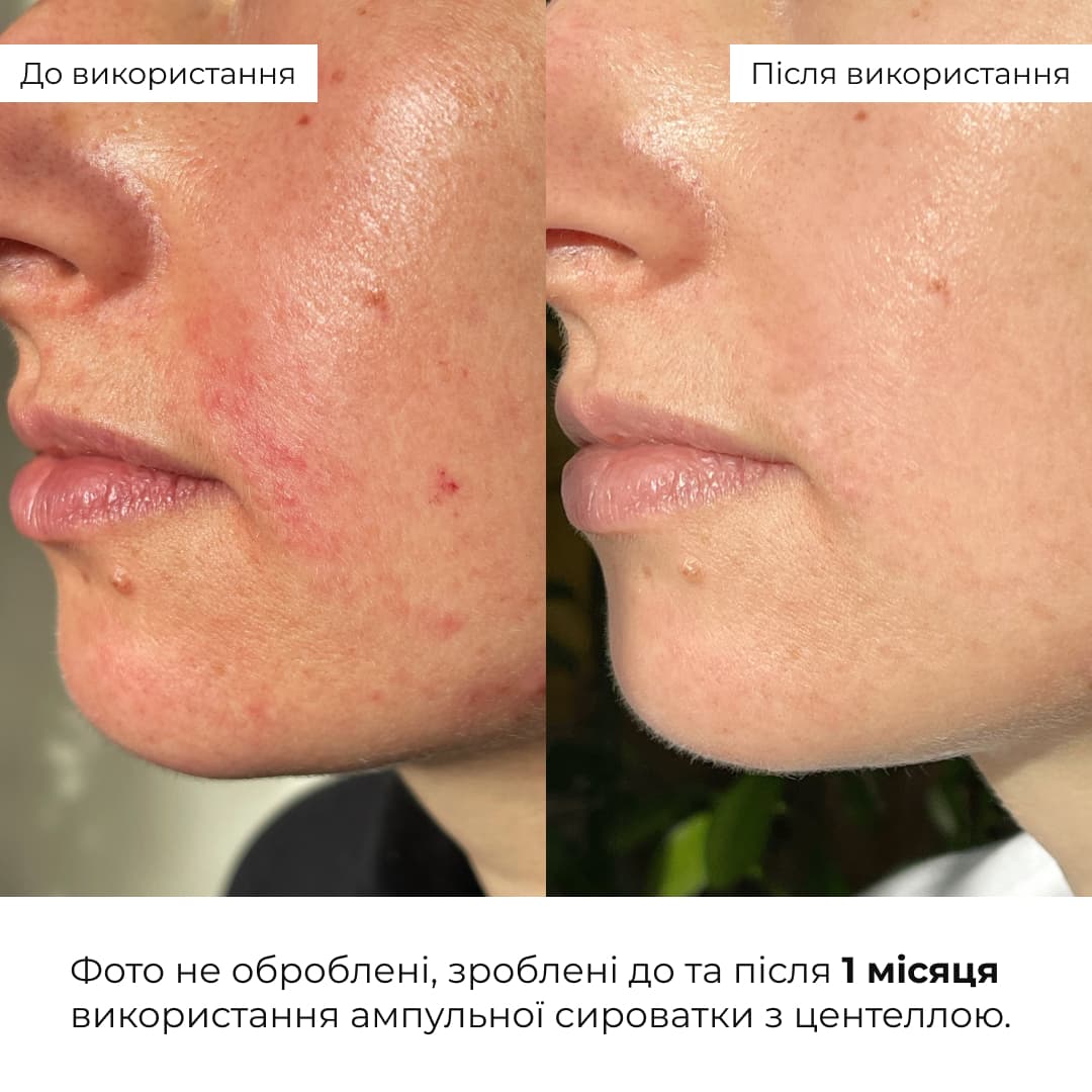 Комплекс щоденного догляду для нормальної та сухої шкіри Hillary Daily Care Complex for Normal & Dry Skin thumbnail