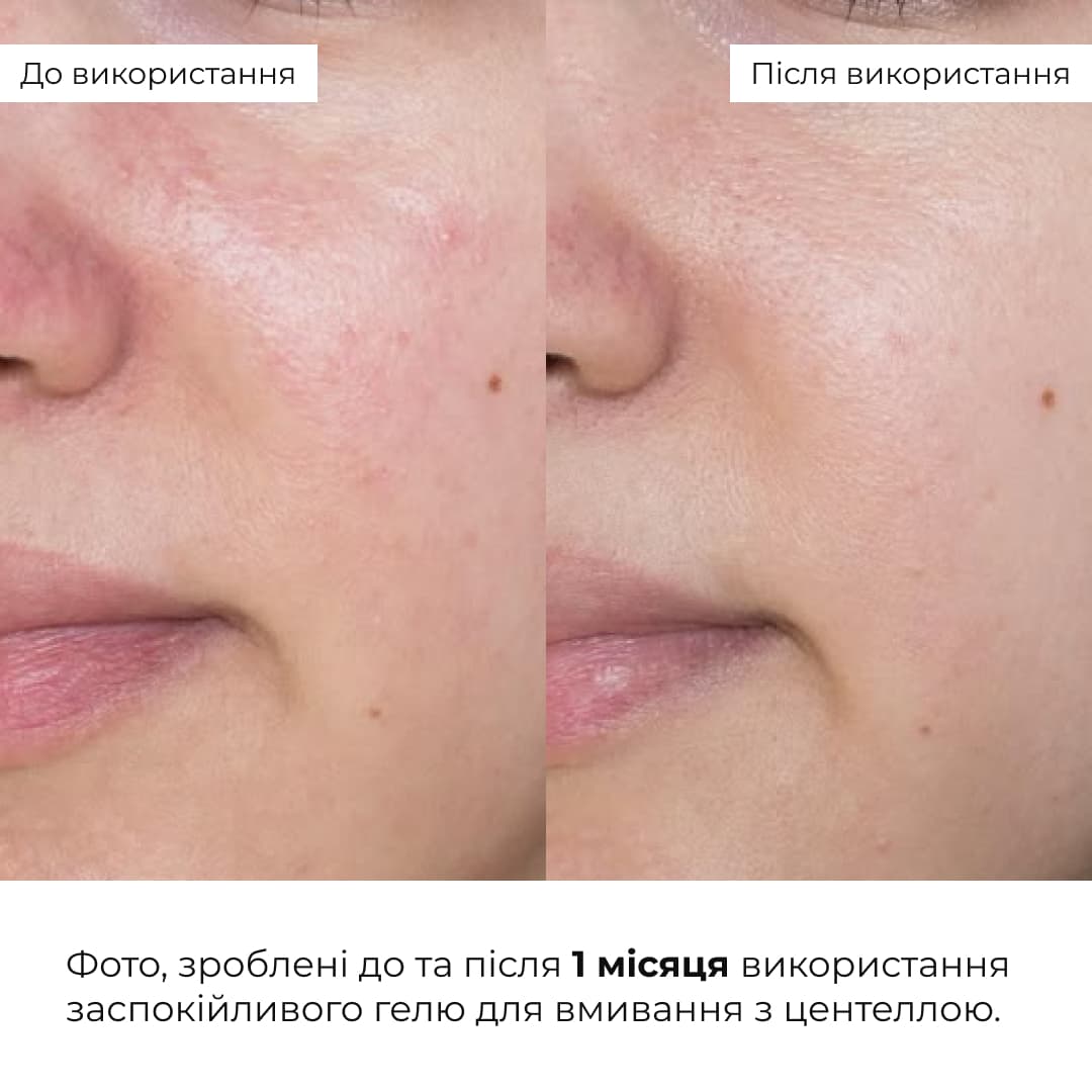 Комплекс щоденного догляду для нормальної та сухої шкіри Hillary Daily Care Complex for Normal & Dry Skin thumbnail