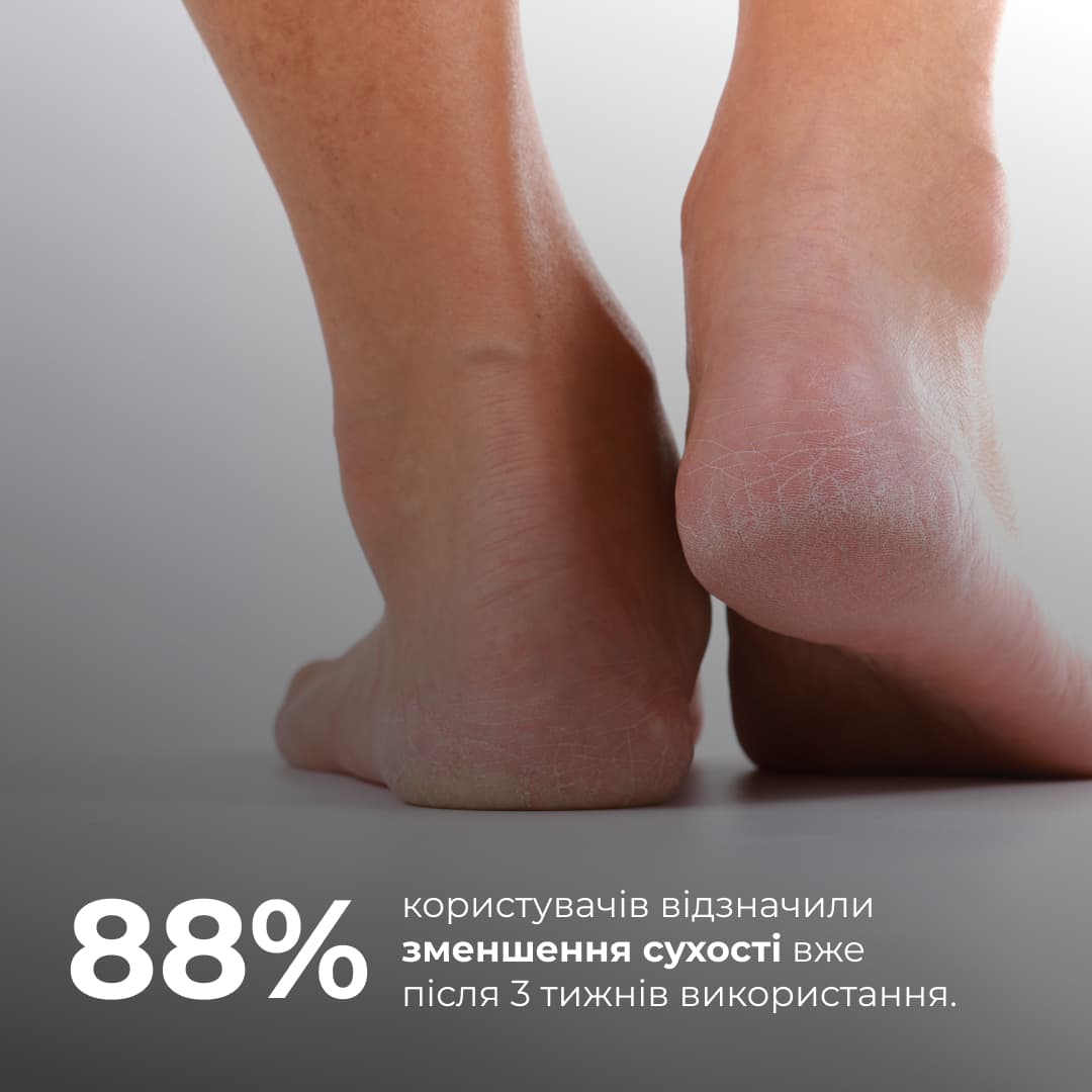 Набір для потрісканих п’ят із розмарином та ромашкою Hillary HydraHeel Repair & Comfort Set thumbnail