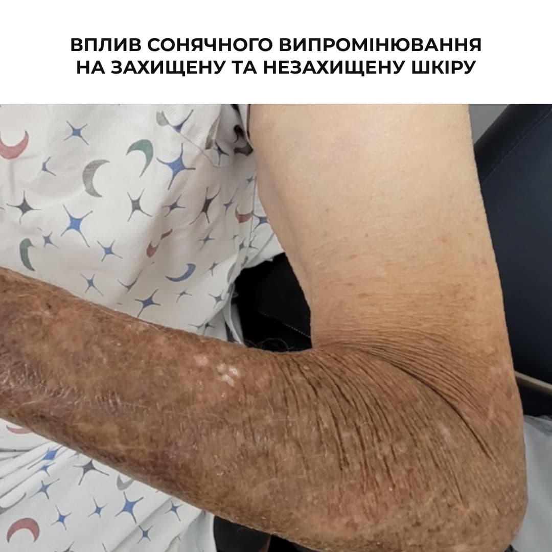 Набір для захисту шкіри обличчя і тіла від фотостаріння SPF 50+ Hillary Face & Body Photoaging Defense Set thumbnail