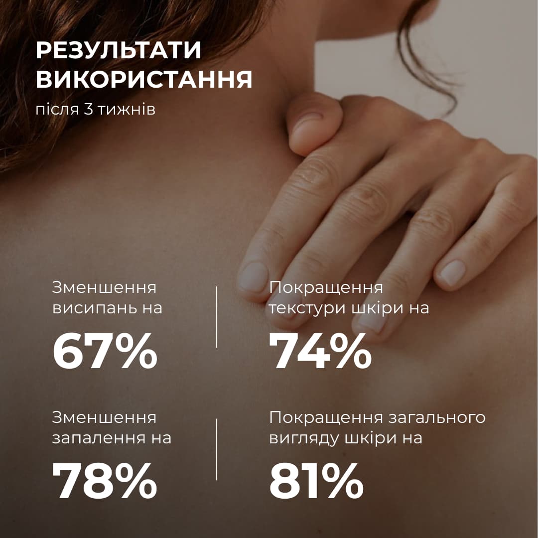 Набір проти запалень і висипань на тілі Hillary Back & Body Acne Care Set thumbnail
