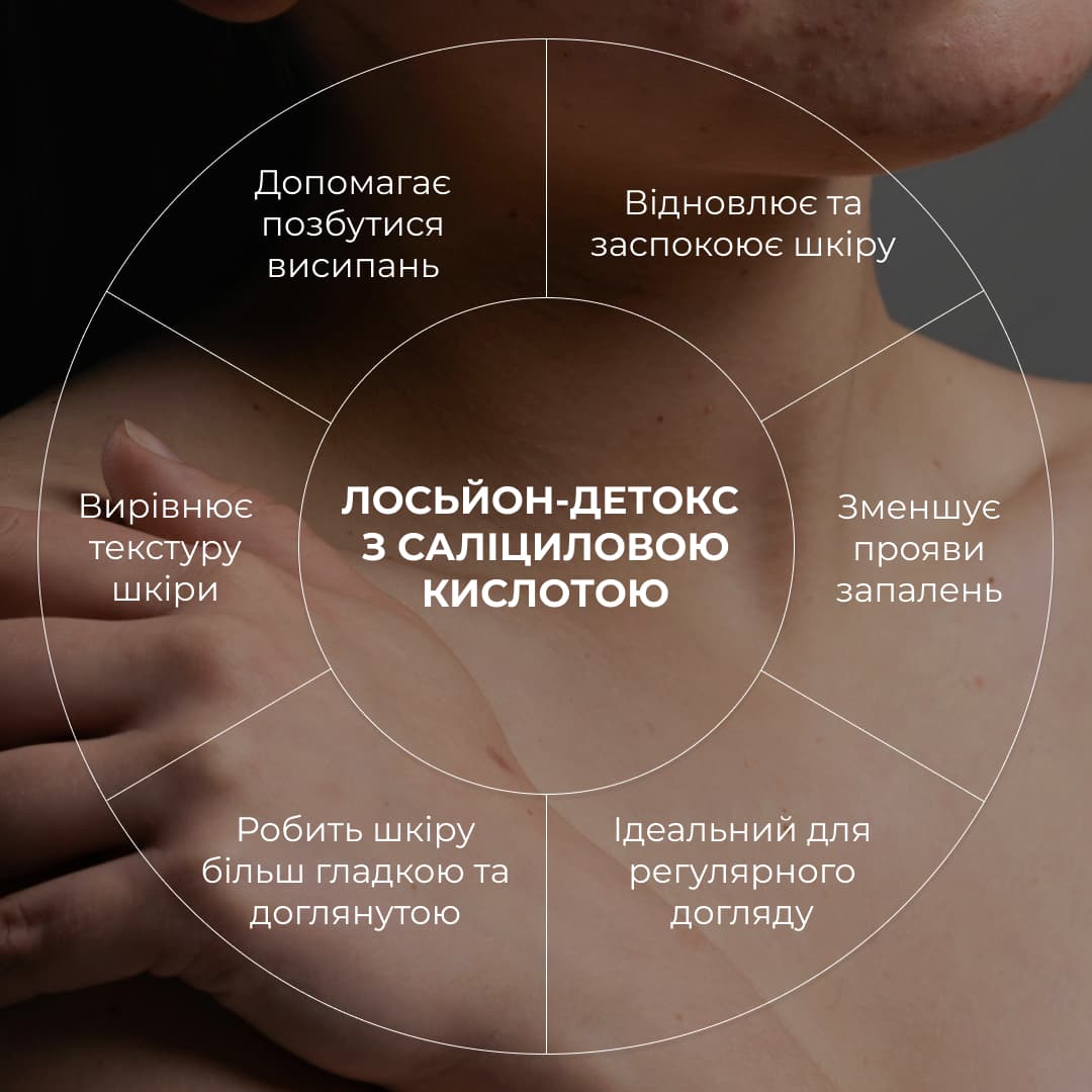 Набір проти запалень і висипань на тілі Hillary Back & Body Acne Care Set thumbnail
