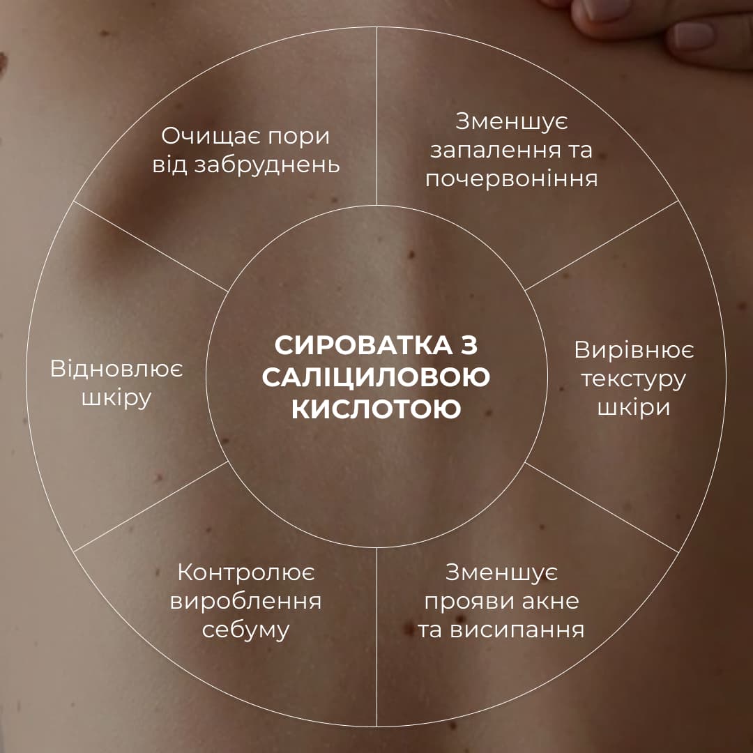 Набір проти запалень і висипань на тілі Hillary Back & Body Acne Care Set thumbnail