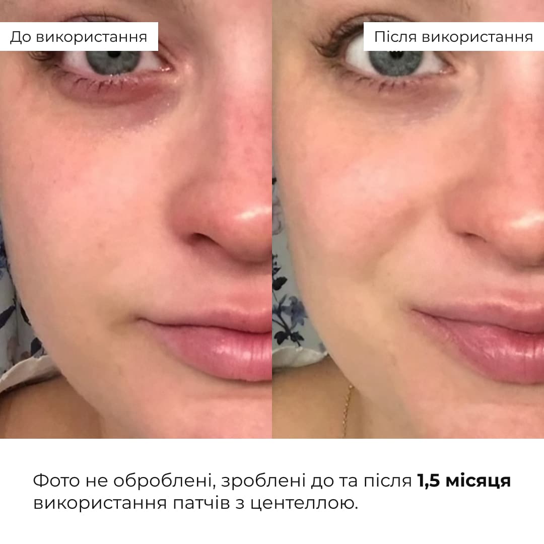 Комплекс нічного догляду для зменшення видимості зморшок HiLLARY thumbnail