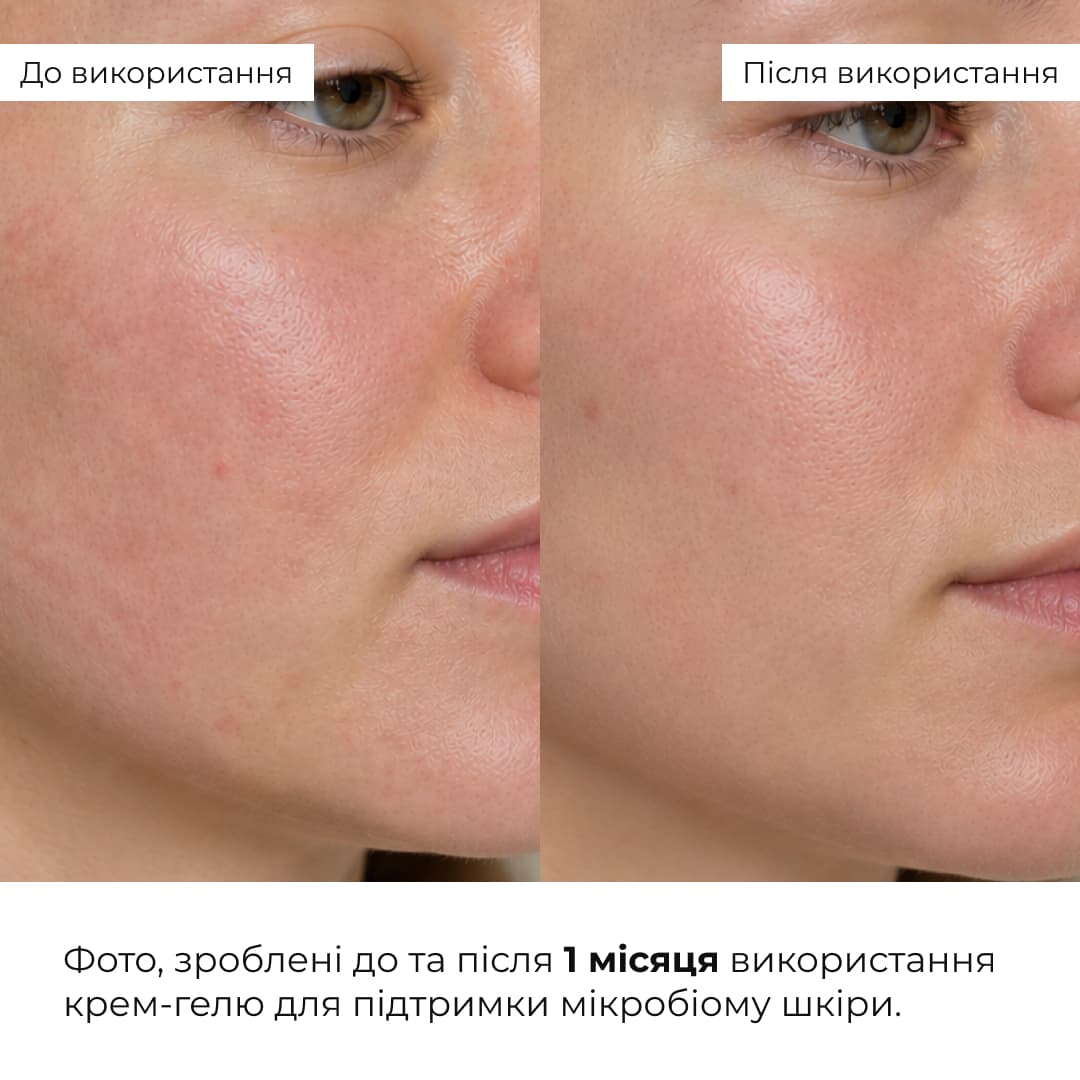Комплекс для заспокоєння шкіри та зменшення набряклості навколо очей HiLLARY thumbnail