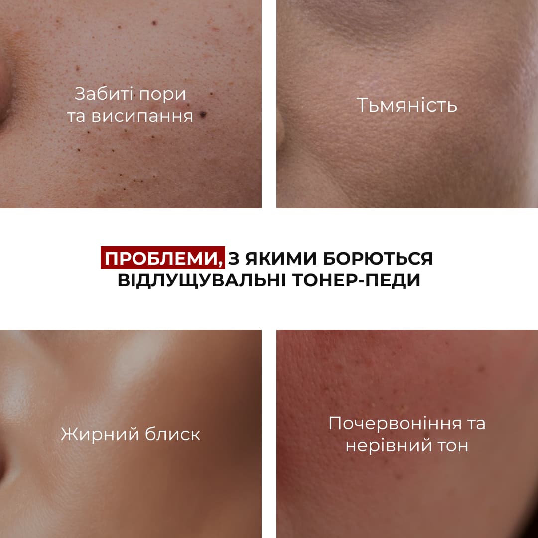 Комплекс інтенсивного оновлення та себорегуляції Hillary Intensive Renewal & Sebo-Regulating Set thumbnail