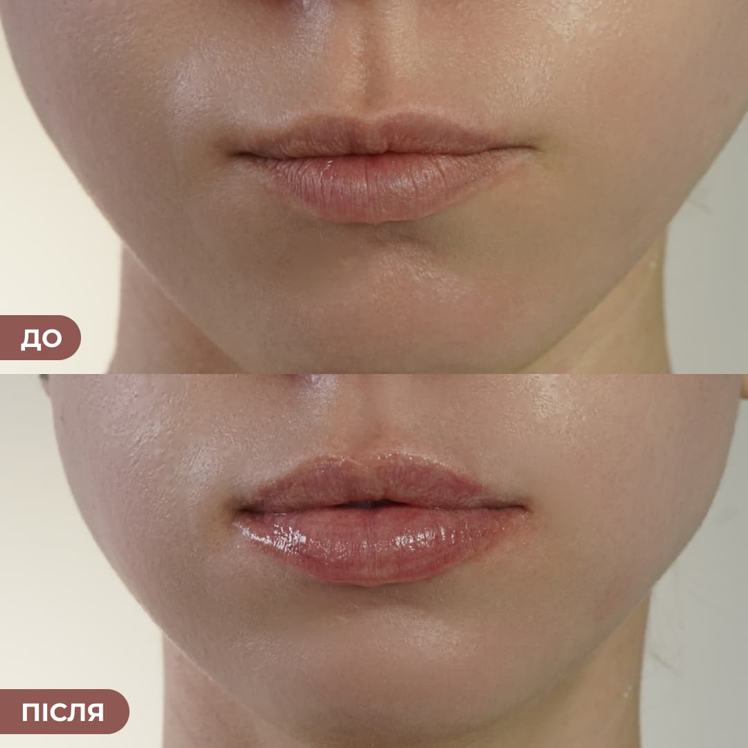 Набір блисків для інтенсивного зволоження та сяючих губ Hillary Deep Hydration & Radiance Lip Trio thumbnail