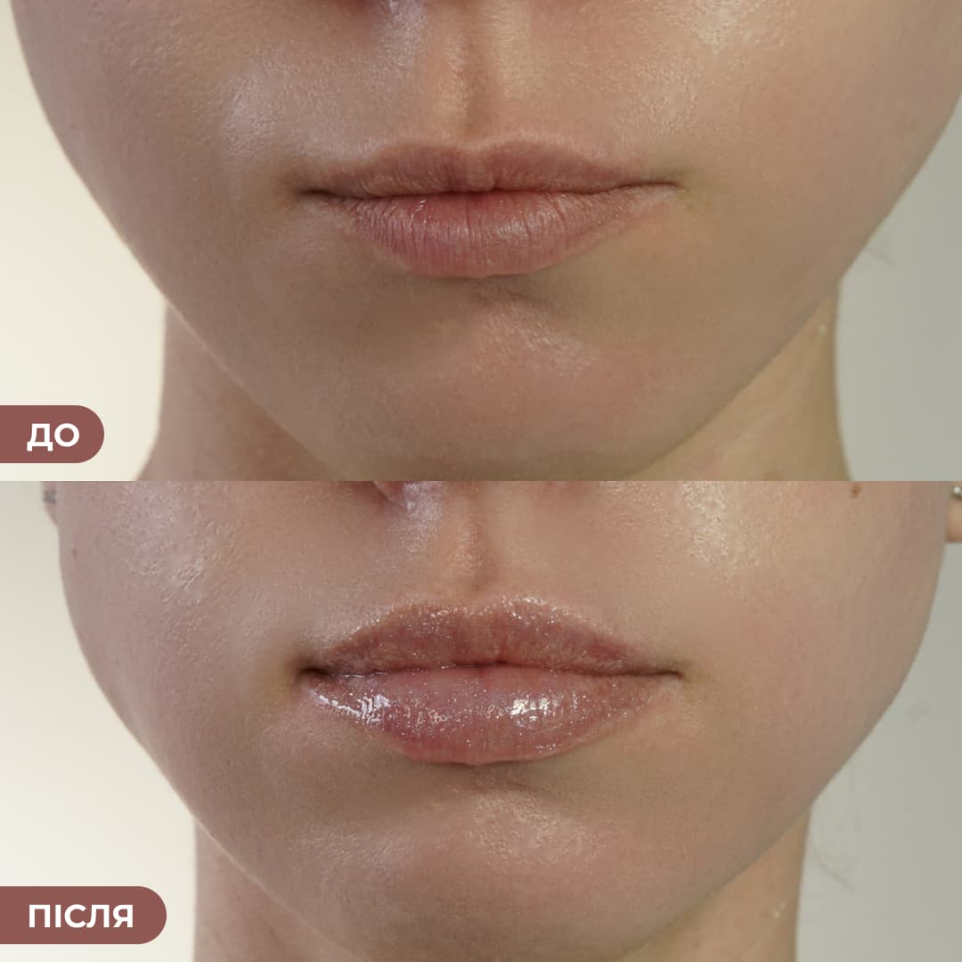 Набір блисків для інтенсивного зволоження та сяючих губ Hillary Deep Hydration & Radiance Lip Trio thumbnail