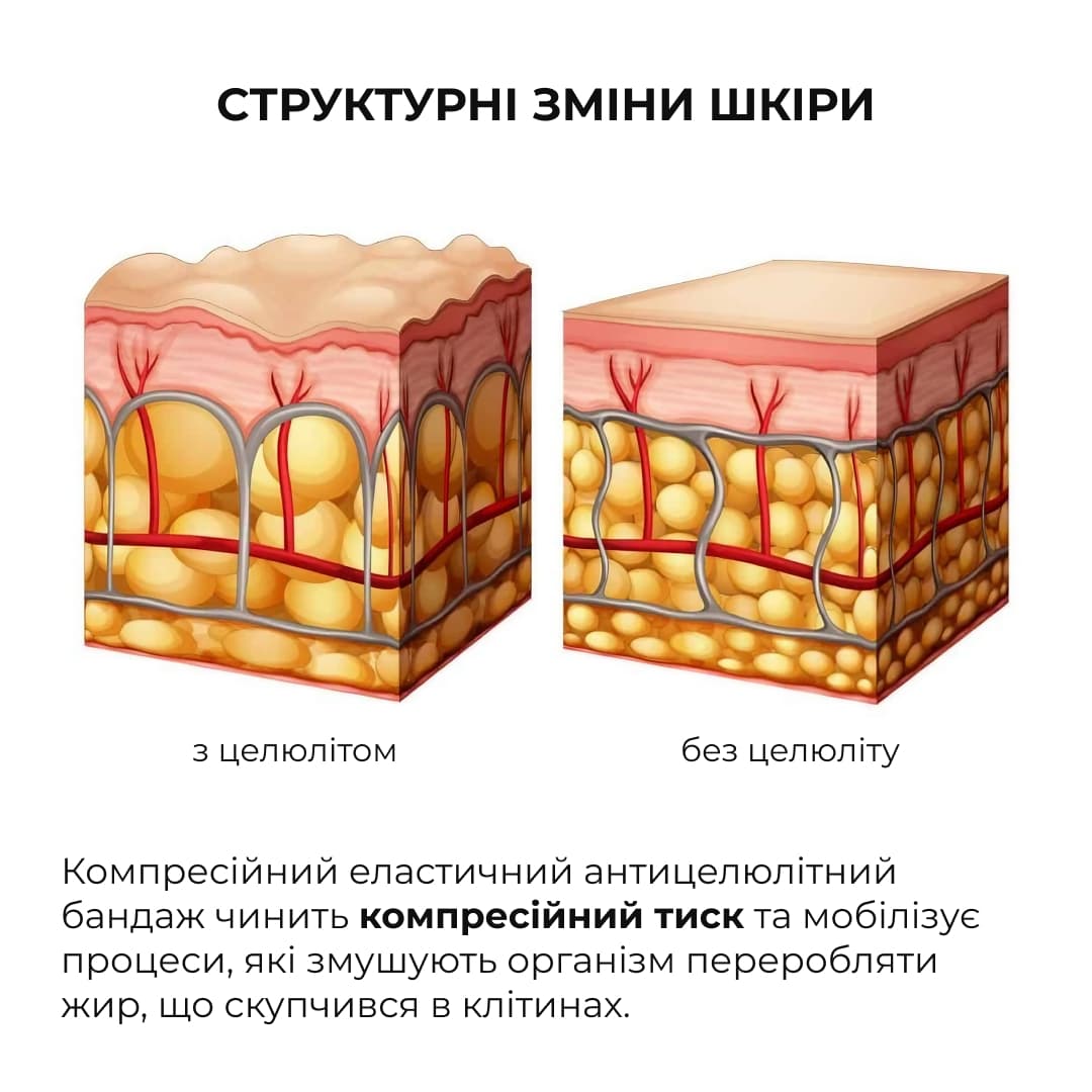 Набір антицелюлітних охолоджувальних обгортань Hillary Cooling Anti-Cellulite Wrap Set thumbnail