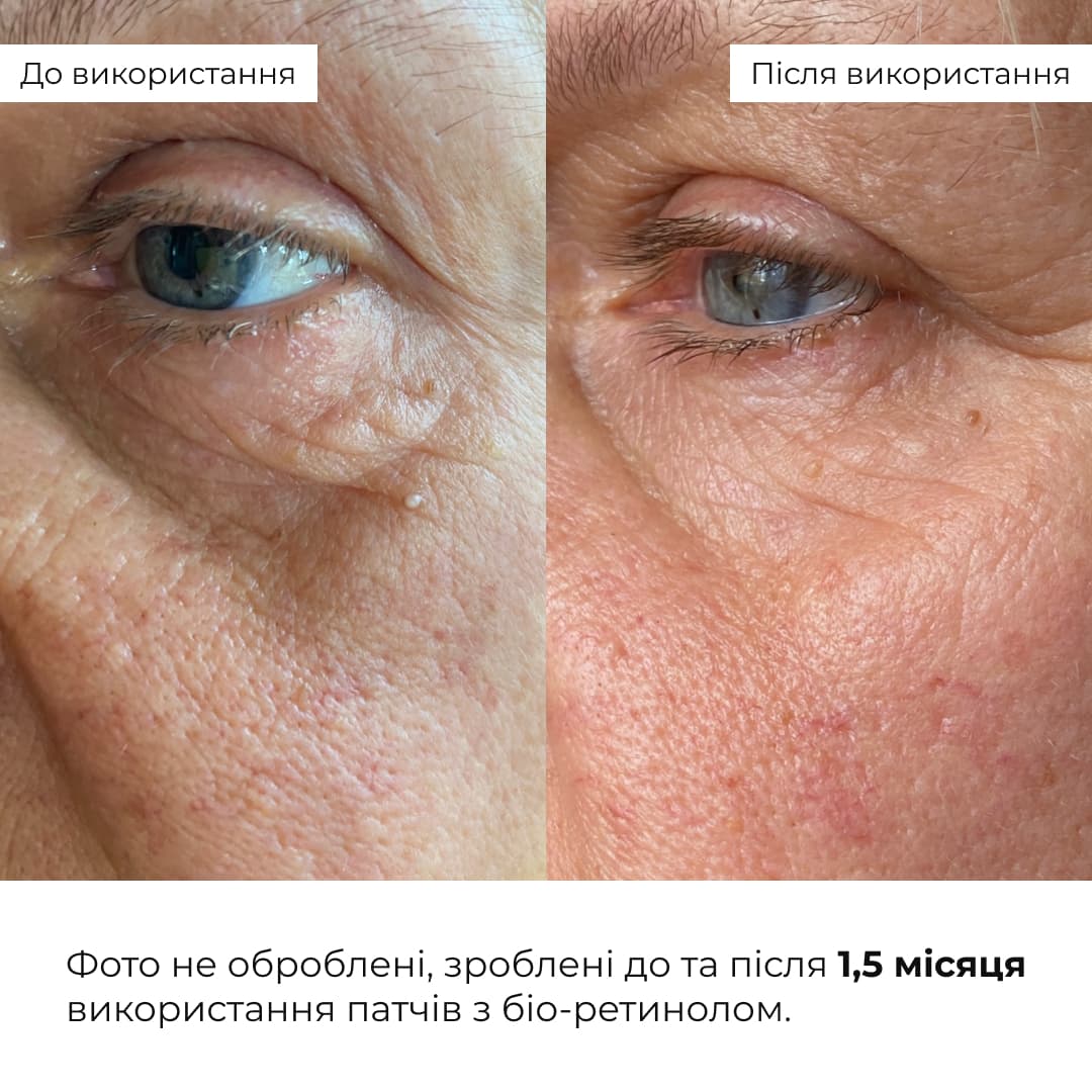 Комплект для ліфтингу шкіри обличчя та зволоження губ Hillary Face Lifting & Lip Hydration Set thumbnail