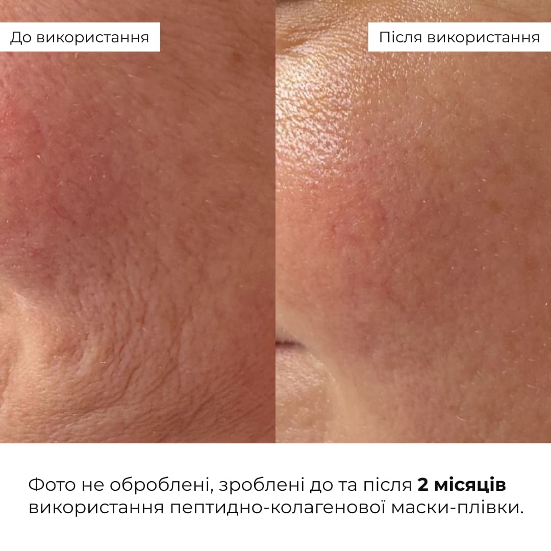 Комплект для ліфтингу шкіри обличчя та зволоження губ Hillary Face Lifting & Lip Hydration Set thumbnail