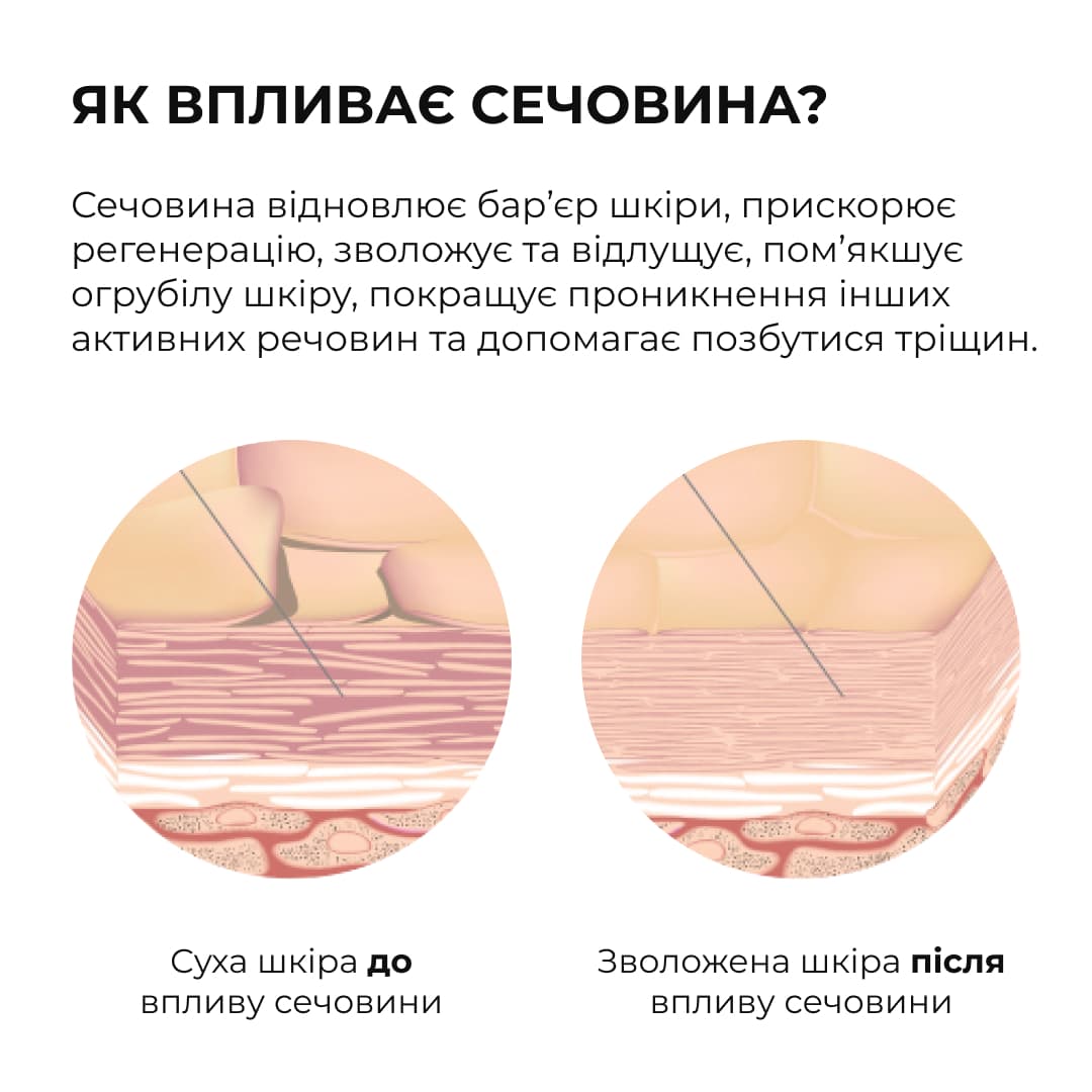 Комплекс для пом’якшення та відновлення потрісканих п’ят Hillary Cracked Heel Softening & Repair Complex thumbnail