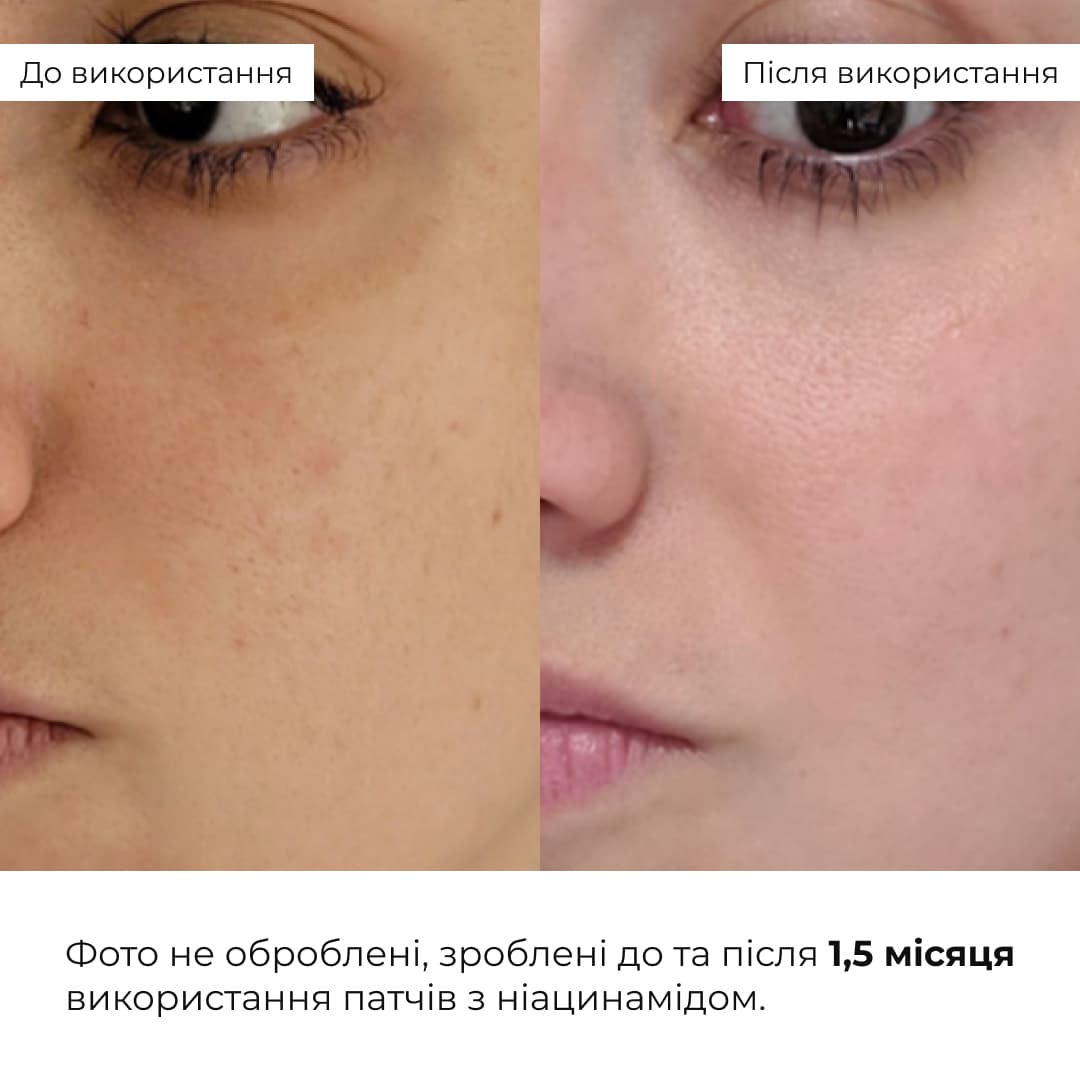Комплект проти тьмяності шкіри обличчя та сухості губ Hillary Set Against Dull Skin and Dry Lips thumbnail