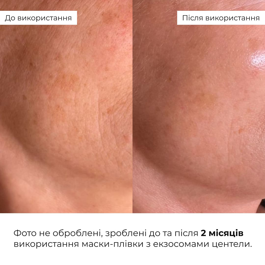Комплект проти тьмяності шкіри обличчя та сухості губ Hillary Set Against Dull Skin and Dry Lips thumbnail