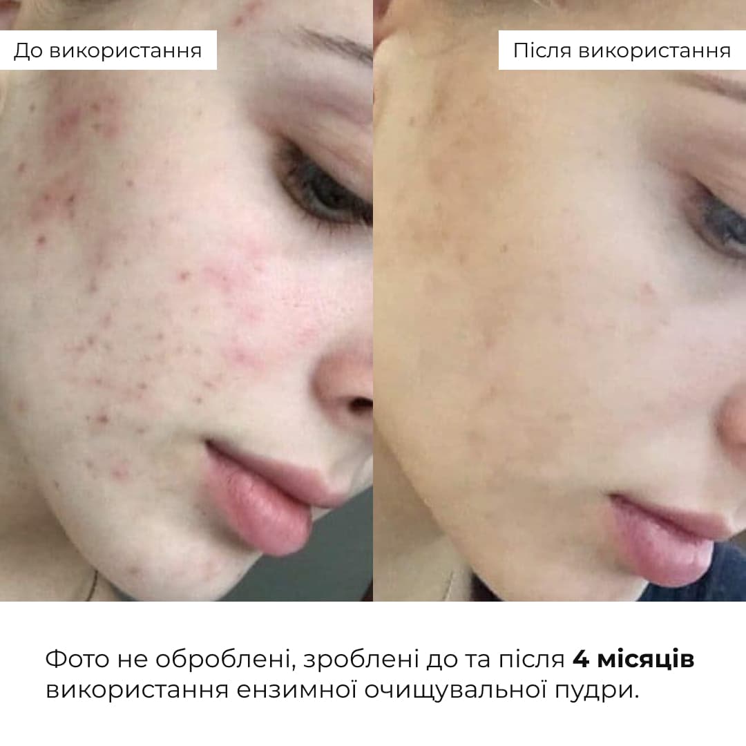 Набір для чутливої та сухої шкіри з центеллою і пробіотиками Hillary Centella & Probiotic Set for Delicate Skin thumbnail