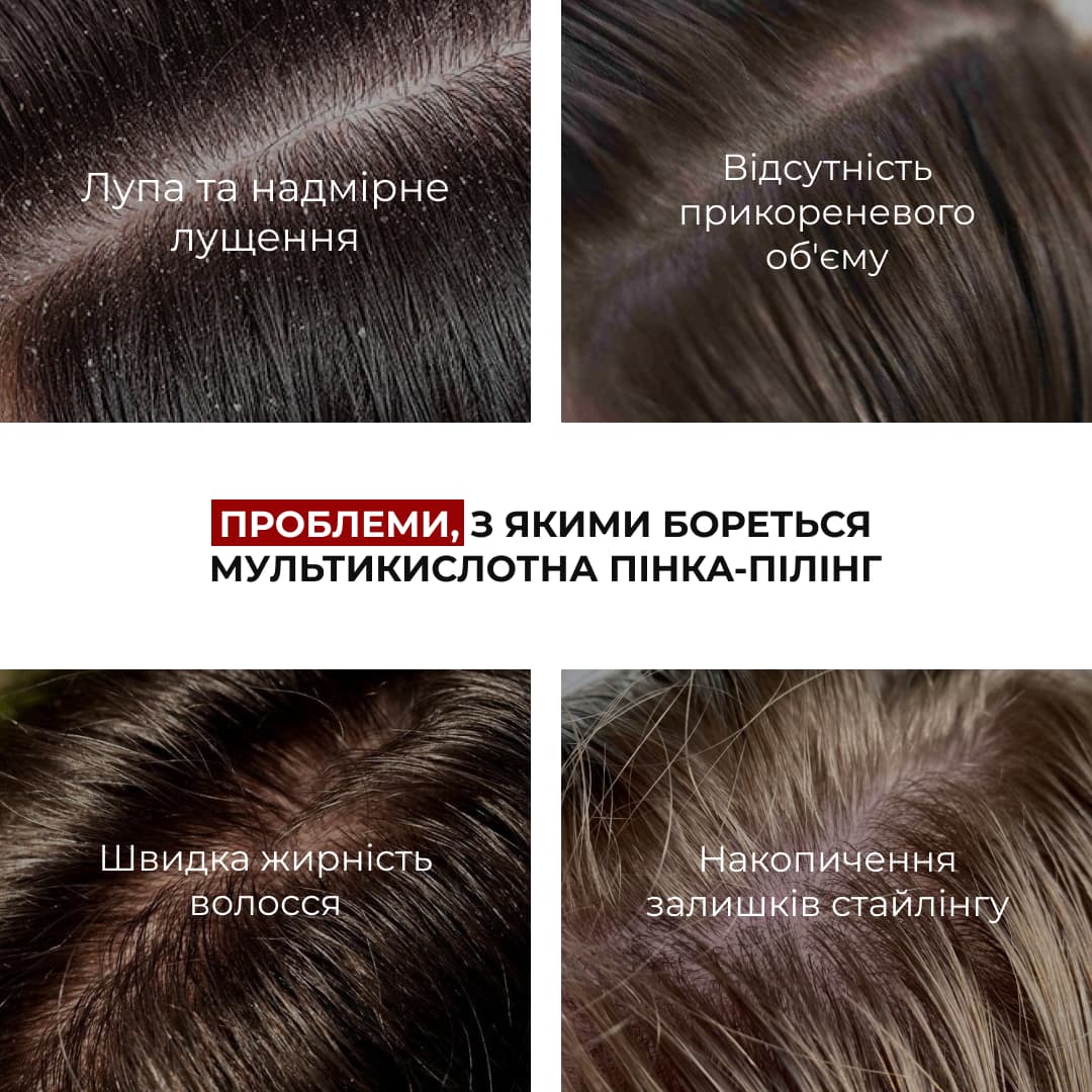 Набір для глибокого очищення шкіри голови та захисту волосся Hillary Deep Scalp Cleansing & Hair Protection Set thumbnail